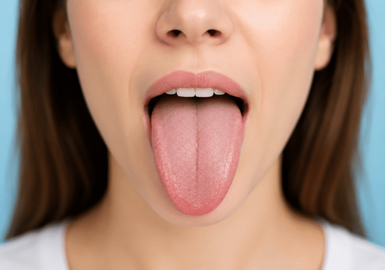 Tongue analysis Tongue analysis